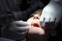 Laserowe leczenie zębów